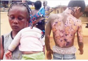 wicked woman set boy ablaze