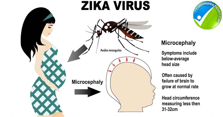 zika virus